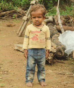 A Family and Girl Child Fight With the Malnutrition